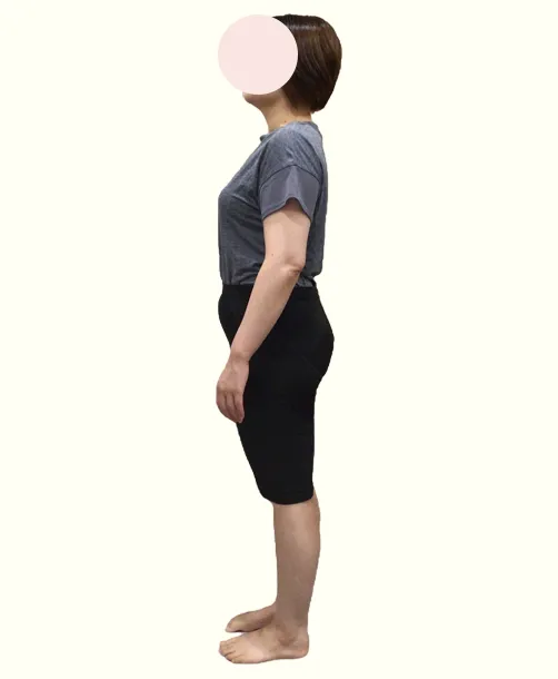 ビフォー